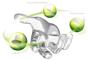 mano cirugia - Cirug&iacute;a Oral Guiada