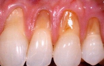 encias - Odontolog&iacute;a General y Est&eacute;tica