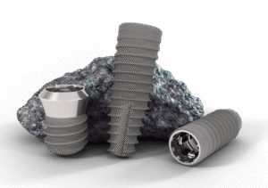 roxolid e1784710008747 300x211 - Implantes dentales