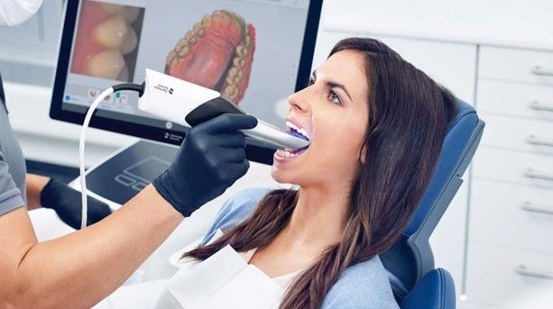 Escaner intraoral - Restauraciones prostodonticas
