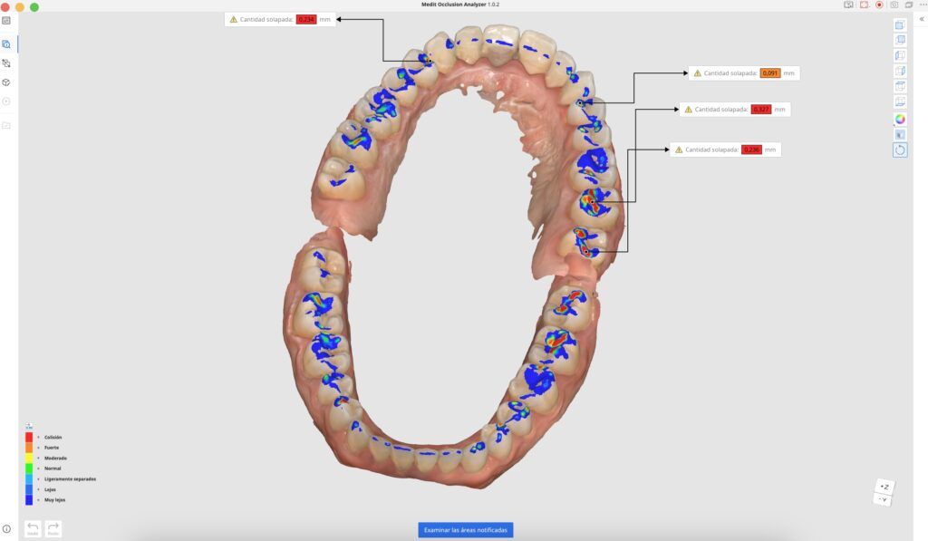 analisis 1 1024x597 - Odontolog&iacute;a General y Est&eacute;tica
