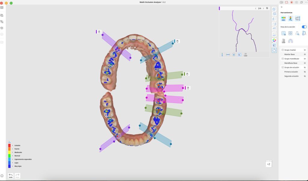 analisis 2 1024x603 - Odontolog&iacute;a General y Est&eacute;tica