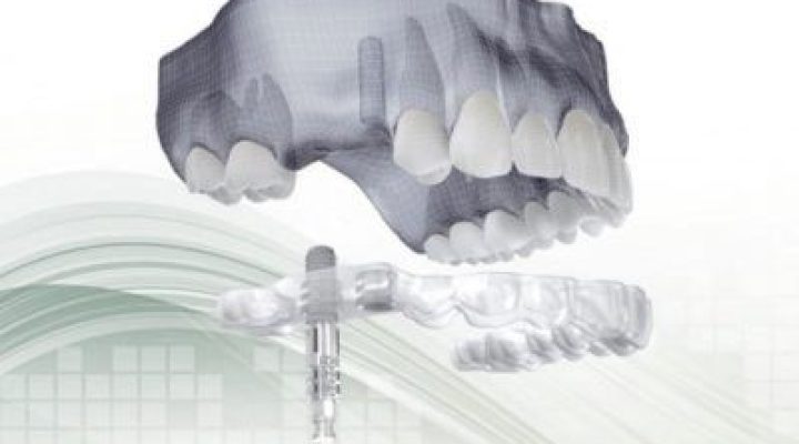 férula r6ni70n045hnvx5tux93snebztzx8o9j0gh8zff5b4 - Inicio