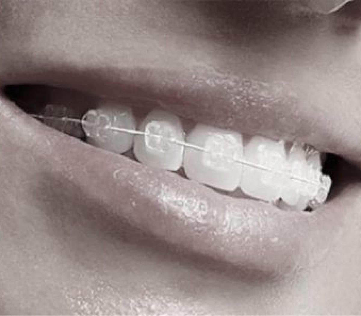 ortodoncia r6makg3ak9prad5cg57688kp56q2lozx2e3ehziih0 - Inicio